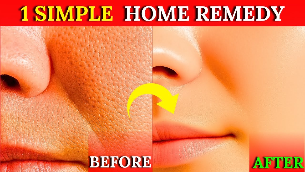 1 Home Remedy For SKIN Tightening And Open Pores