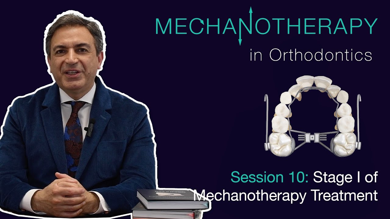 Mechanotherapy in Orthodontics Vol II: Stage I of Mechanotherapy Treatment 