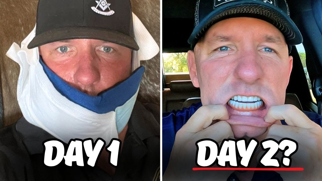 Are Permanent Teeth in 24-Hrs a SCAM?