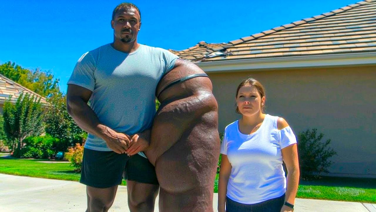 PESSOAS COM PARTES DO CORPO MAIORES QUE O NORMAL