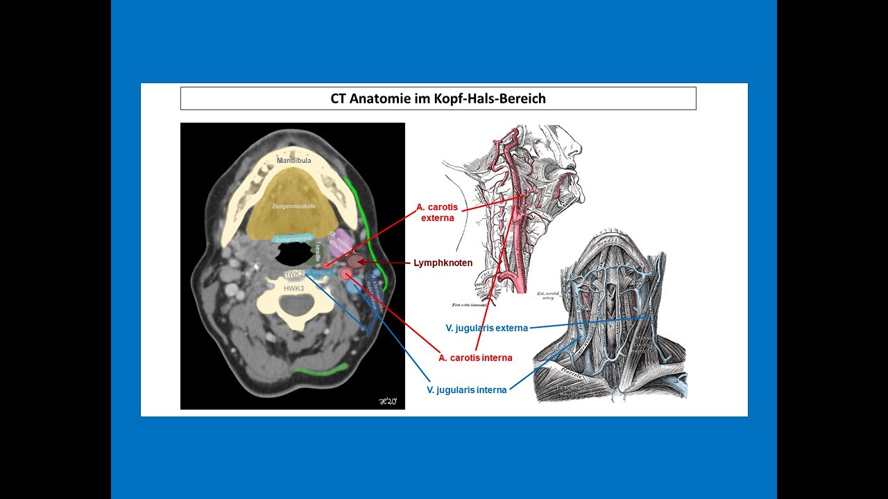 CT Anatomie im Kopf-Hals-Bereich | Strahlentherapie Prof. Hilke Vorwerk