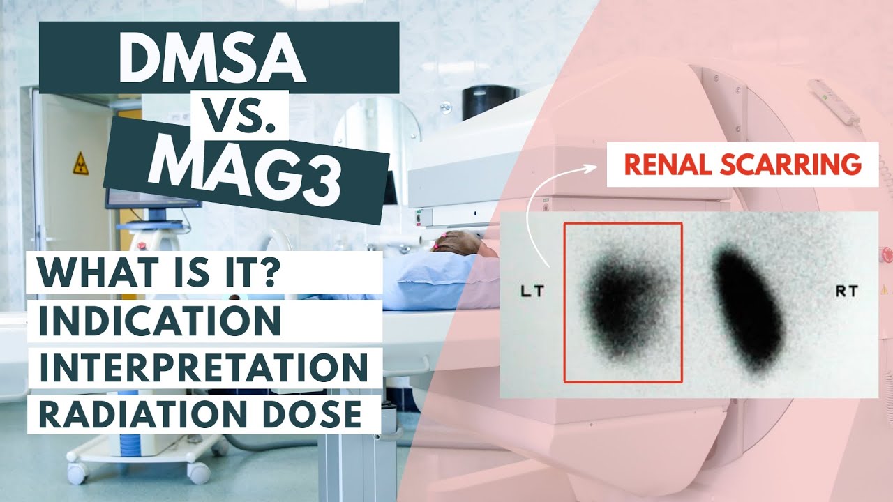 Сравнение сканирования DMSA и MAG3 | Ядерная медицина | Подробный обзор