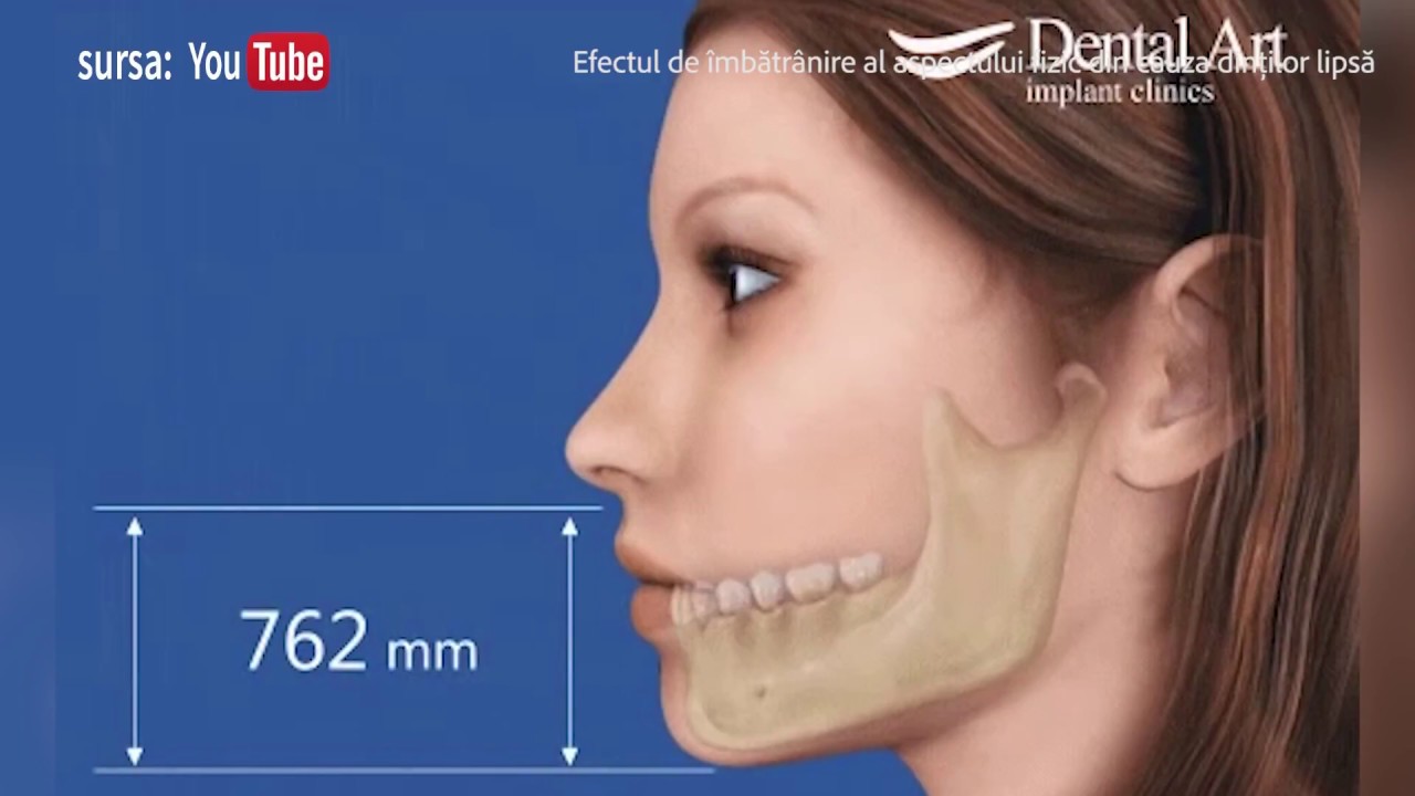 De vorbă cu stomatologul - Adonația și edentația - Dr. Ecaterina Nederiță
