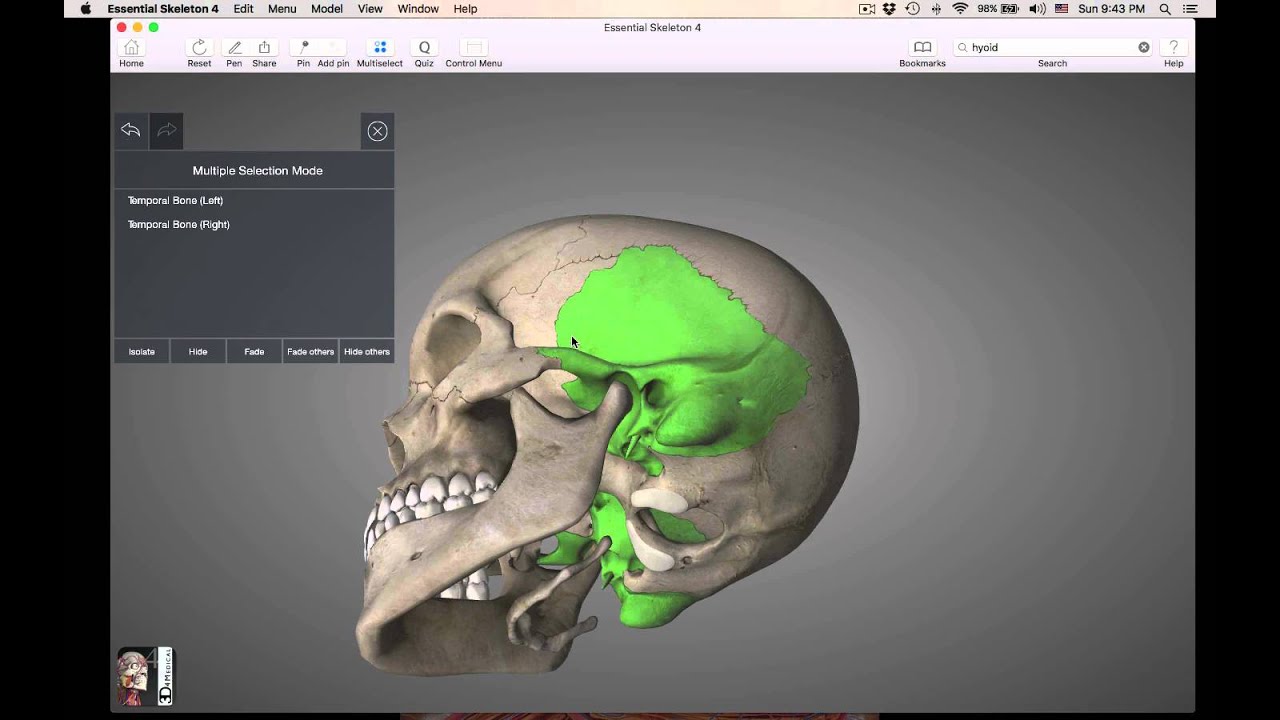 Cranial skull bones
