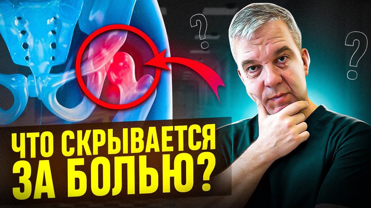 КАК ПРАВИЛЬНО ЛЕЧИТЬ ТАЗОБЕДРЕННЫЙ СУСТАВ? Самый эффективный метод.