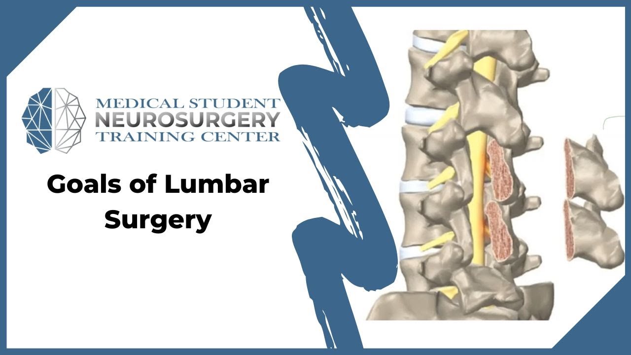 Goals of Lumbar Surgery