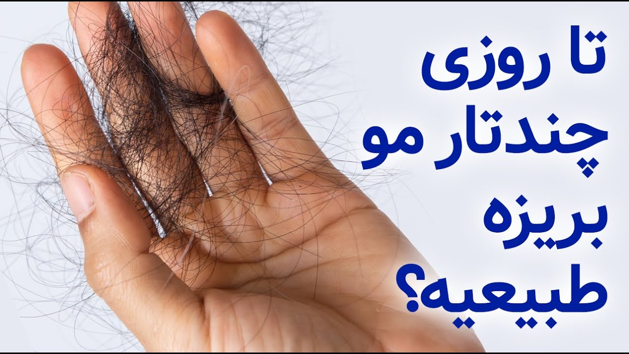 روزی چند تار مو بریزه مشکلی نیست