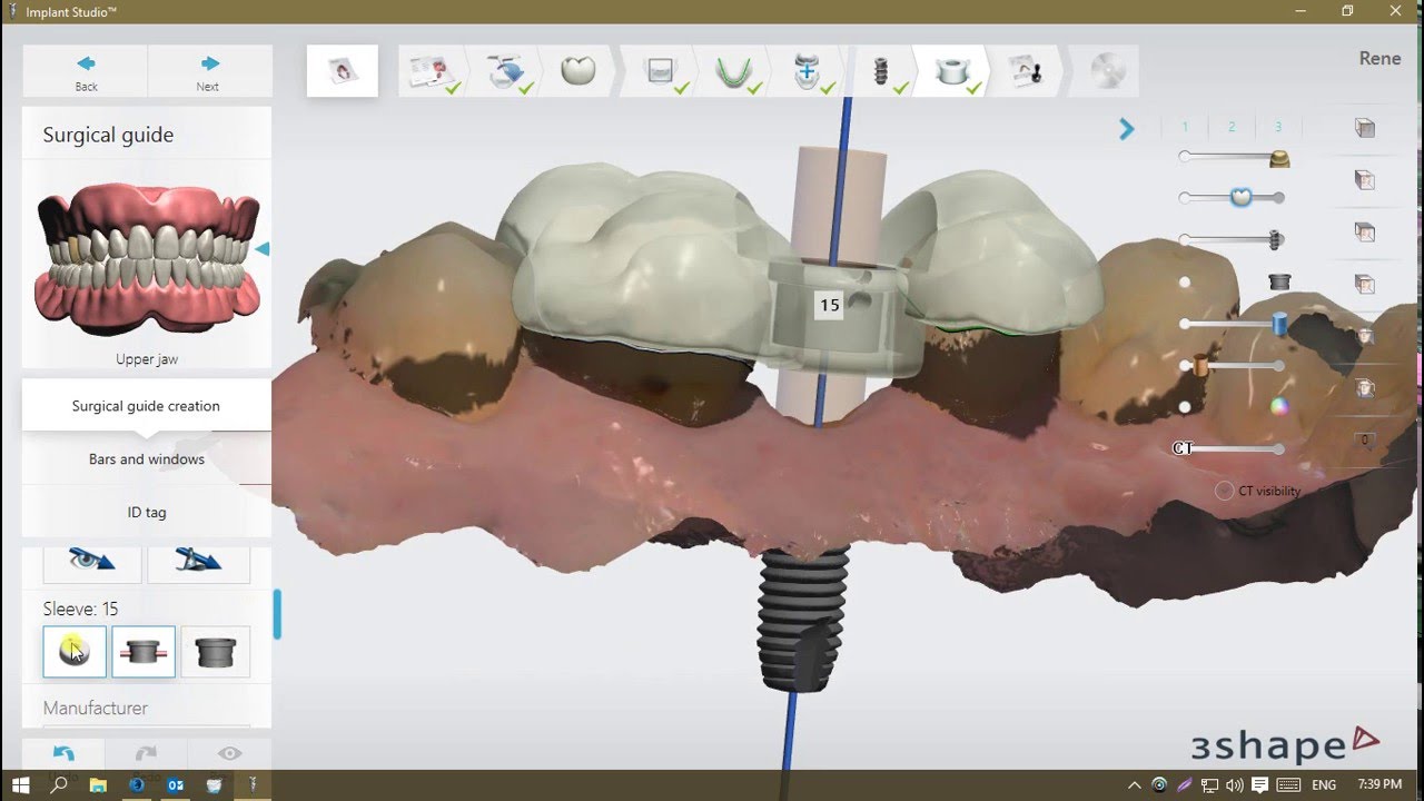 3Shape Implant Studio 2016: Surgical Guide Design