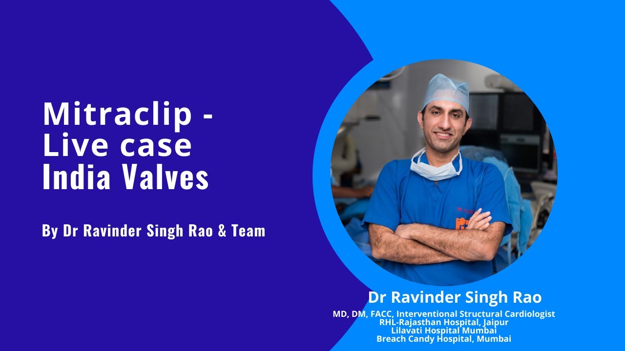 Mitral Valve repair with MitraClip - India Valves, Live case by Dr Ravinder Singh Rao
