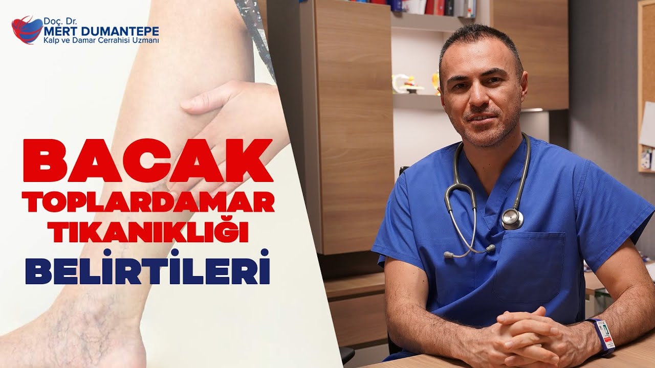 Bacak Toplardamar Tıkanıklığı Belirtileri Nelerdir? - PROF. DR. MERT DUMANTEPE