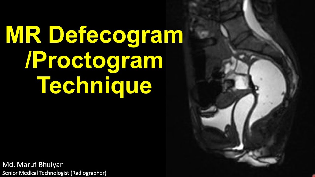 MR Defecogram / Proctogram technique step by step | Protocols | Planning | Anatomy | Case Discussion
