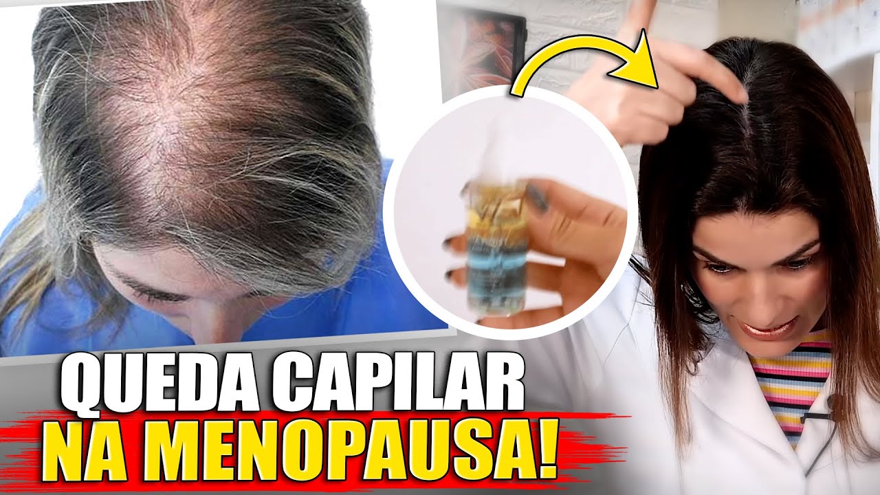 Queda de Cabelo na Menopausa: Causas e Como Tratar de Forma Natural e Segura