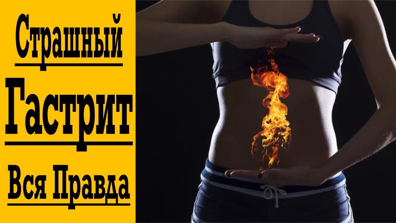 Гастрит – приговор ? Как избавиться от гастрита без лекарств ?