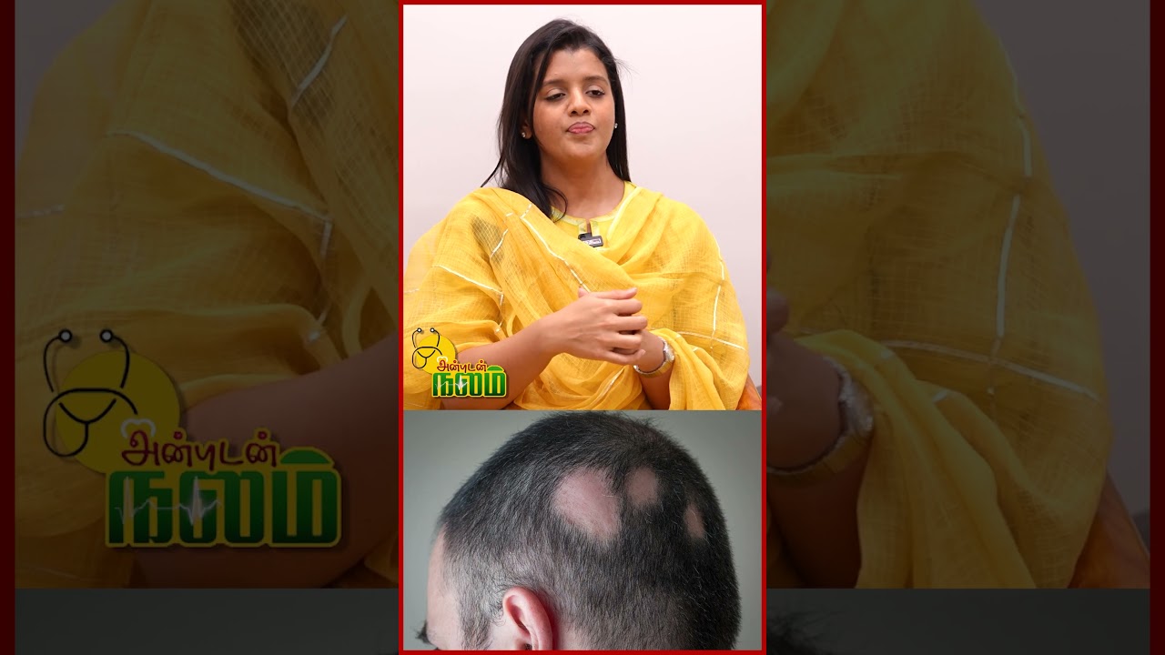 Solution for Alopecia Areata | DR.Poornima | PT Prime