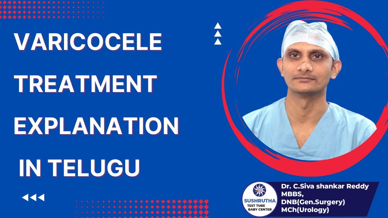 Treatment for Varicocele- Best Explained.