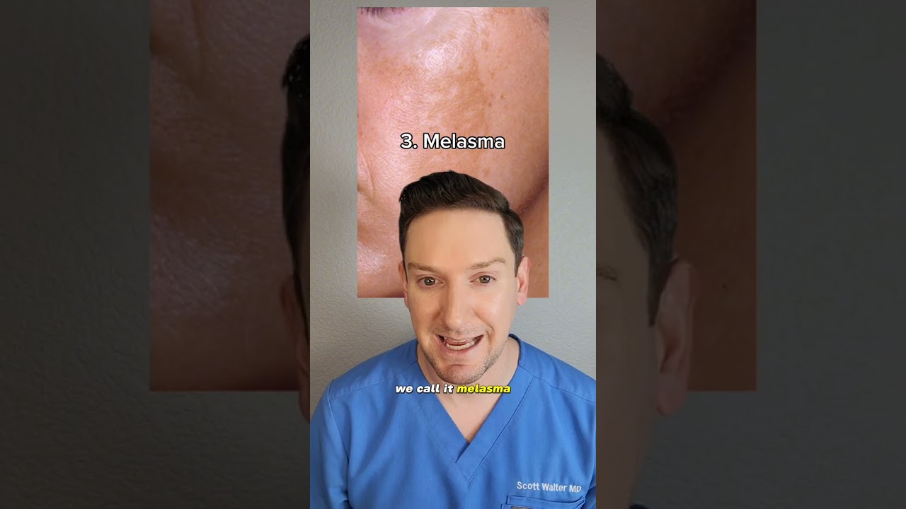 Dark Spots 101: What causes them and how can you get rid of them? #skincare #darkspots #derm