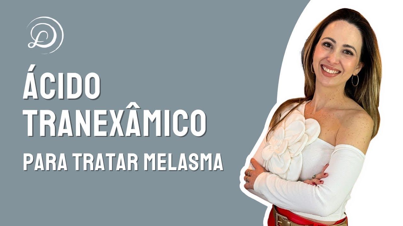 ÁCIDO TRANEXÂMICO PARA TRATAR MELASMA | #melasma #melasmatreatment #tranexamicacid