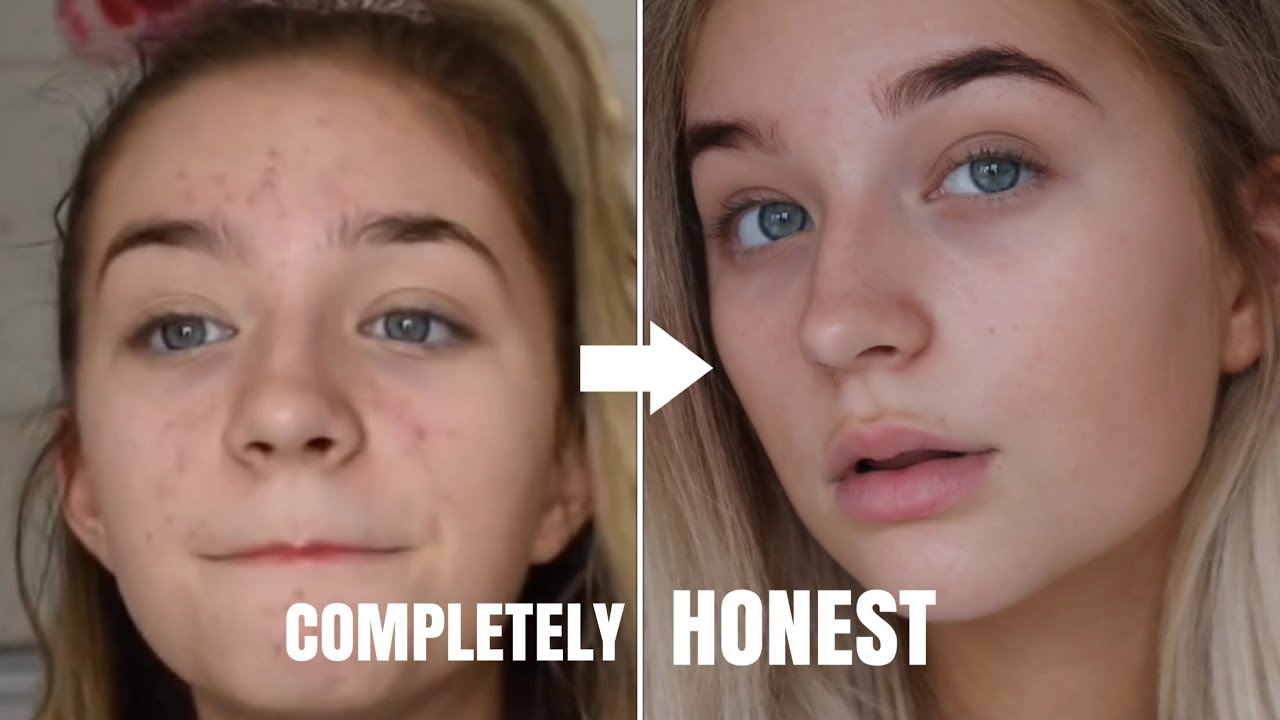 HOW I COMPLETELY CLEARED UP MY SKIN USING ONE PRODUCT! Simply Grace