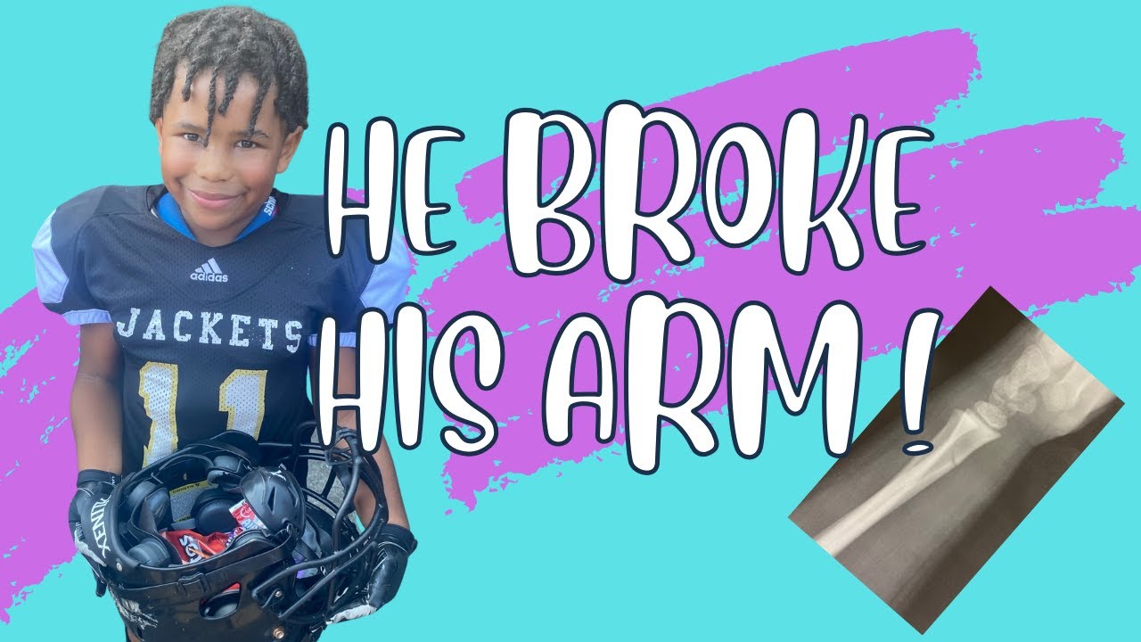 First Broken Bone | Timmy gets a cast | UOC Vlogmas Day 8
