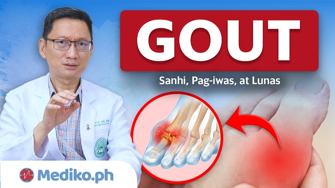 GOUT na UBOD ng SAKIT: Lunas at Pag-Iwas