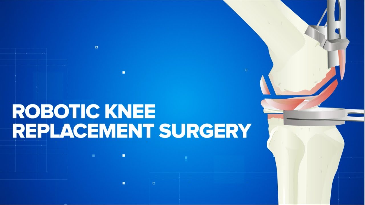 Robotic Knee Replacement Surgery