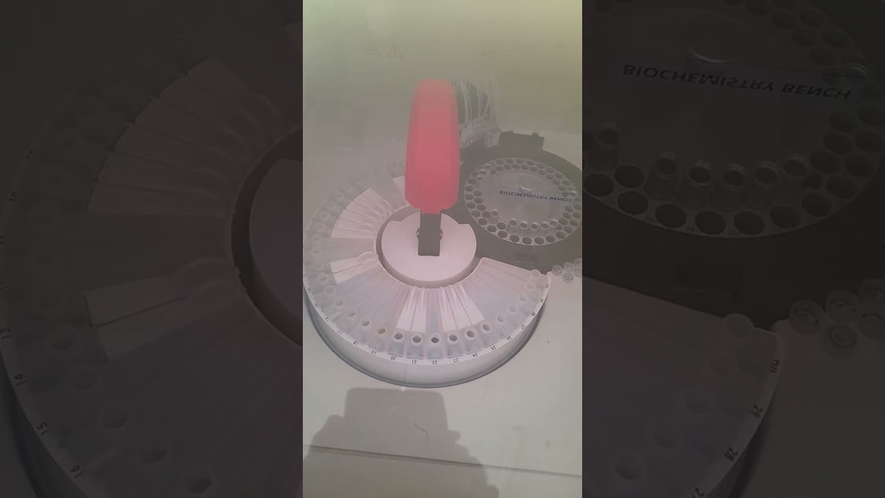 PROCEDURE ON CALIBRATION OF BIOCHEMISTRY  MACHINE HUMASTAR 100   ::1:REAGENT BLANK