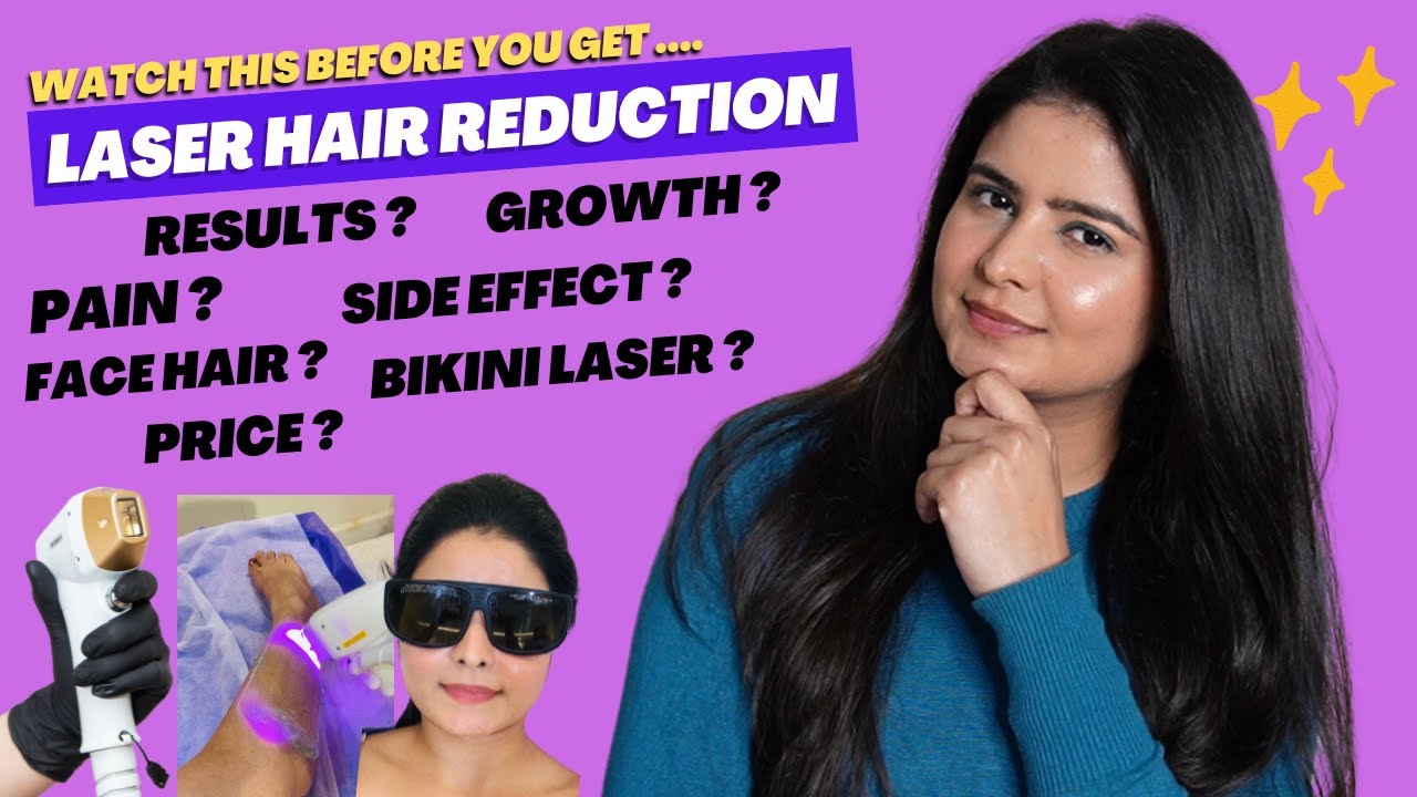 Reality of LASER HAIR REMOVAL ! Growth? Pain? PCOS Hair? Price? Effect? KASHIKA CHAUHAN