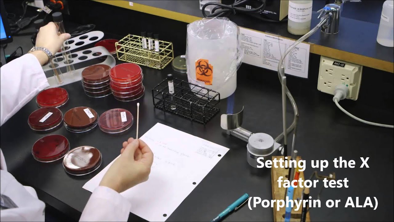 How to Identify Haemophilus influenzae in a Sputum Culture