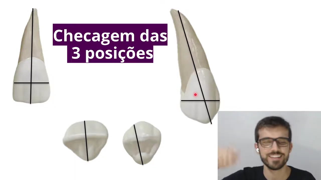 ORTO! Aqui Está Tudo Que Você Mais Precisa Saber Sobre Braquetes, Fios e Elásticos