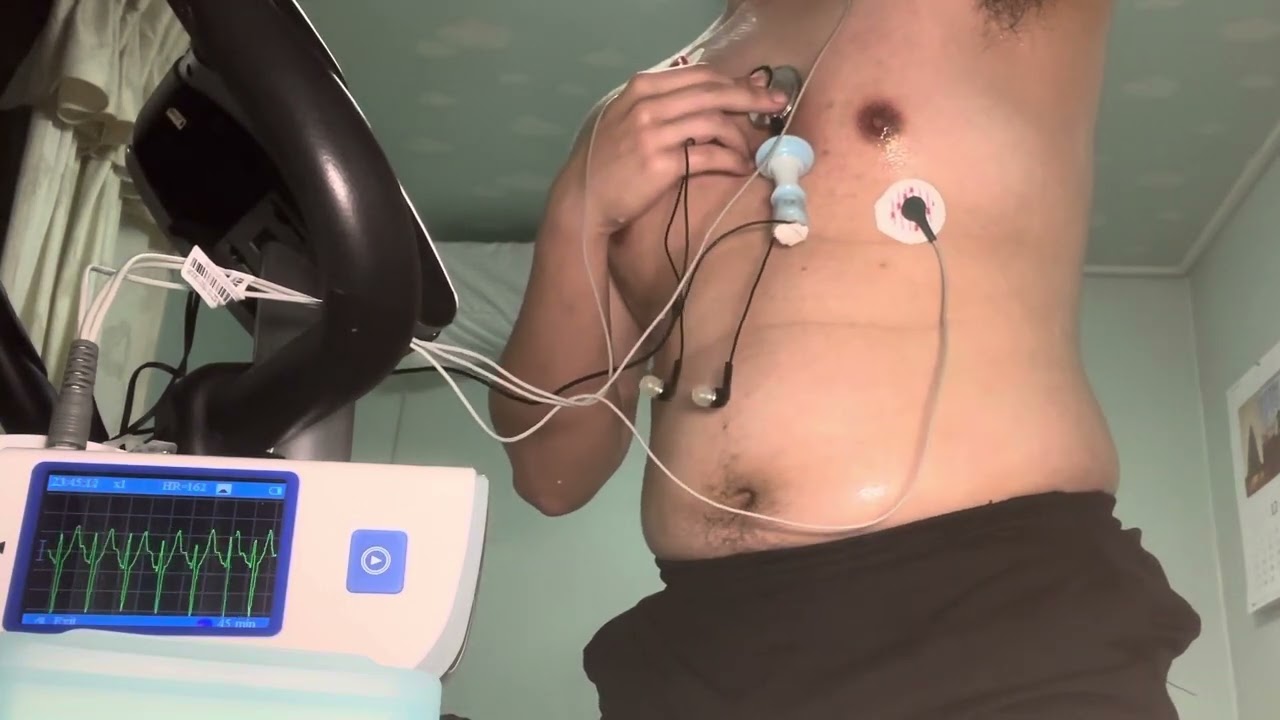 Fast heartbeat after exercise