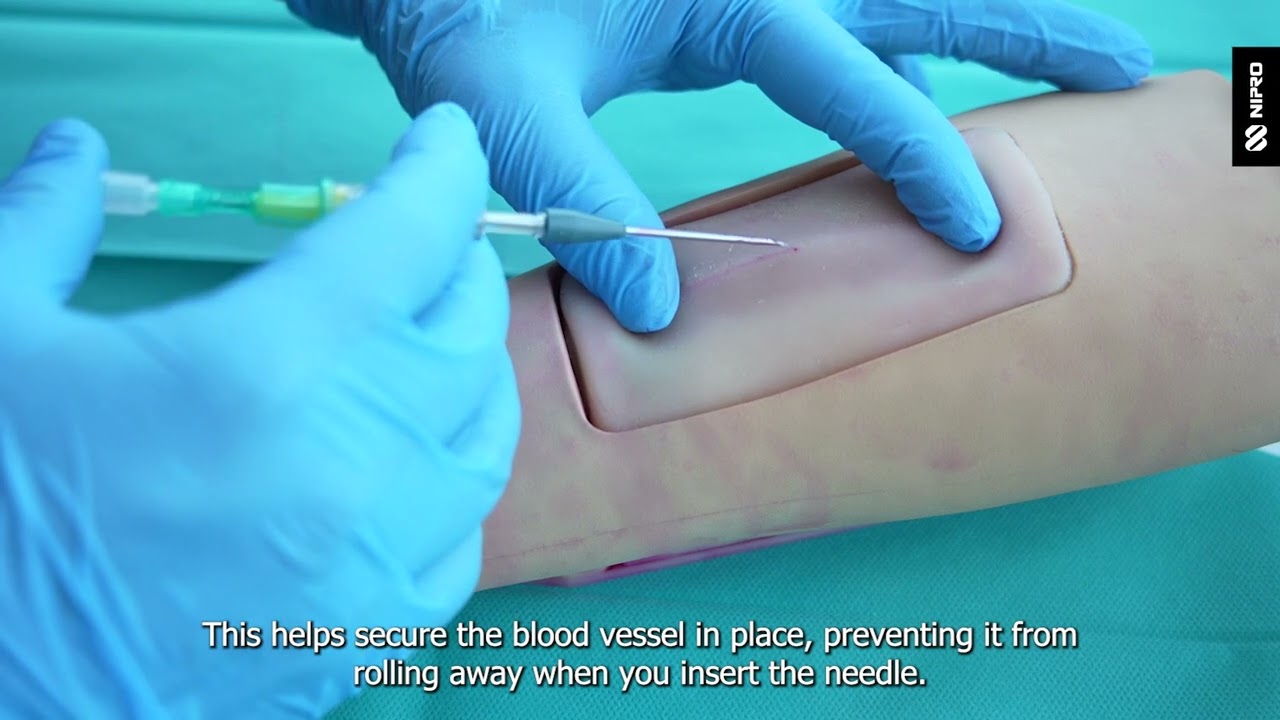 iMEP Tips & Tricks 22: AVF needling techniques