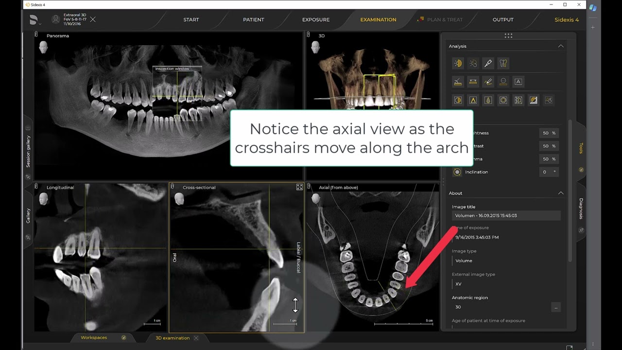 Imaging Training Session 23: Sidexis 4 - Cross-Sectional View