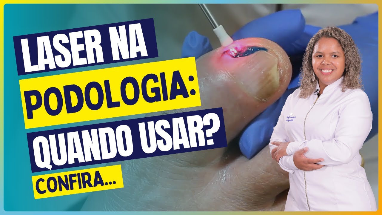 LASER na Podologia: Quando usar?