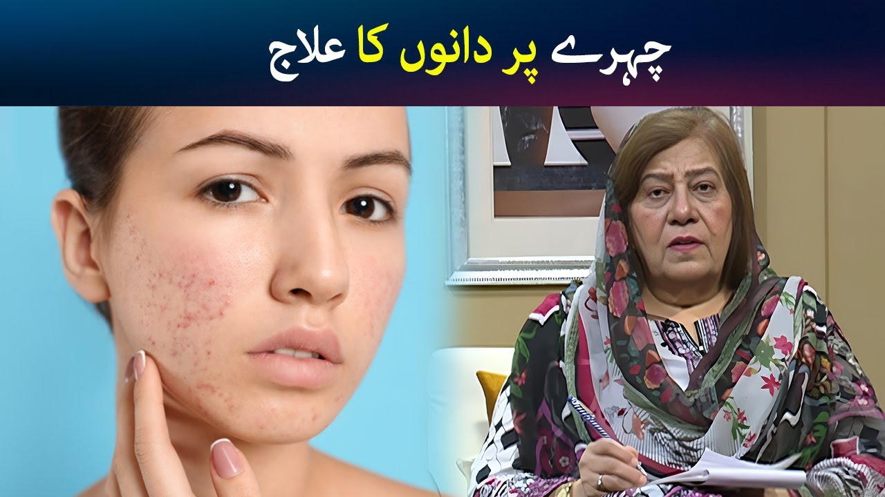 Chehry par dano ka ilaj | Face Pimples | Hashmat Bibi | Avt Khyber