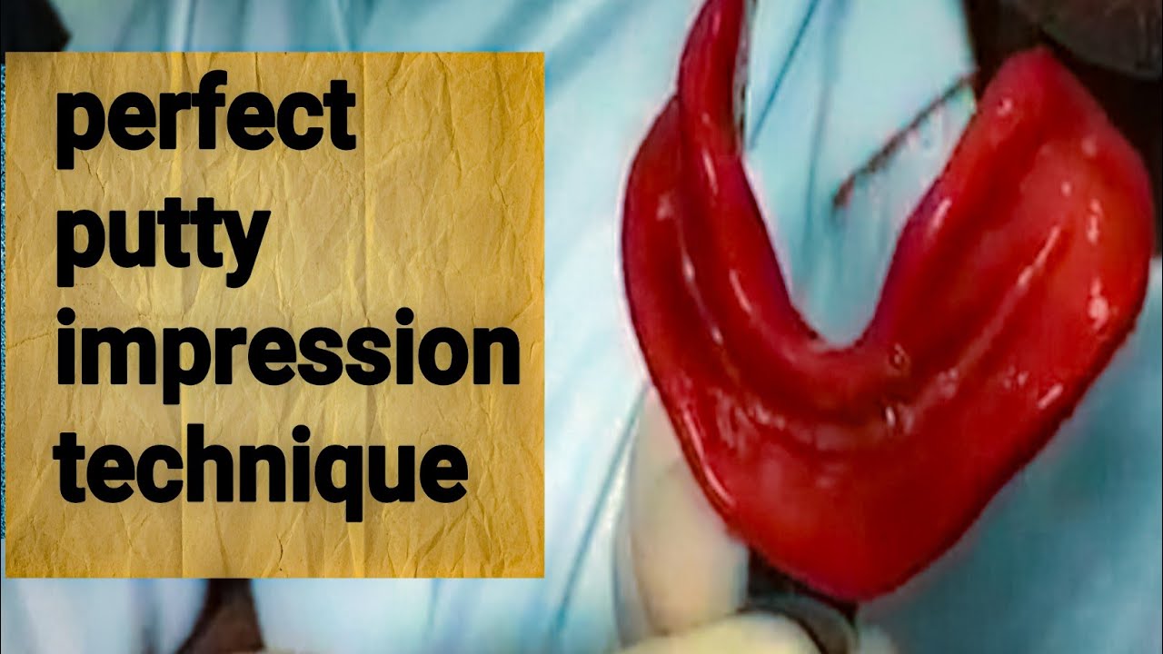 Perfect Putty Impression for Edentulous Patient  | Complete Denture Impression Technique
