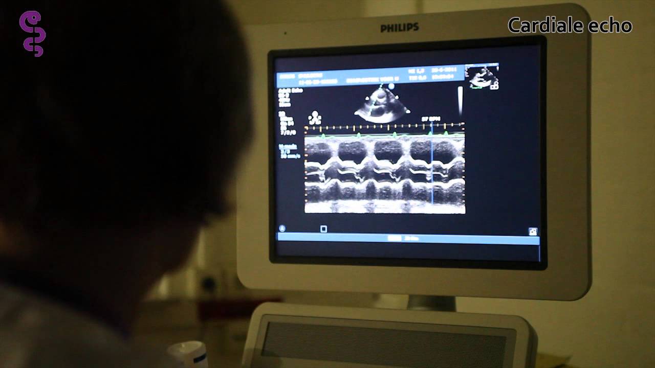 Cardiale echo