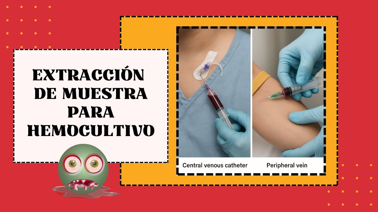 Extracci&oacute;n de muestra para HEMOCULTIVO