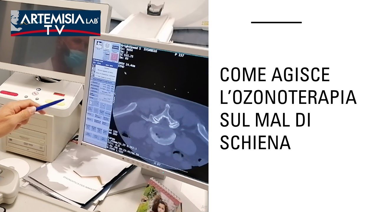 COME AGISCE L'OZONOTERAPIA SUL MAL DI SCHIENA?