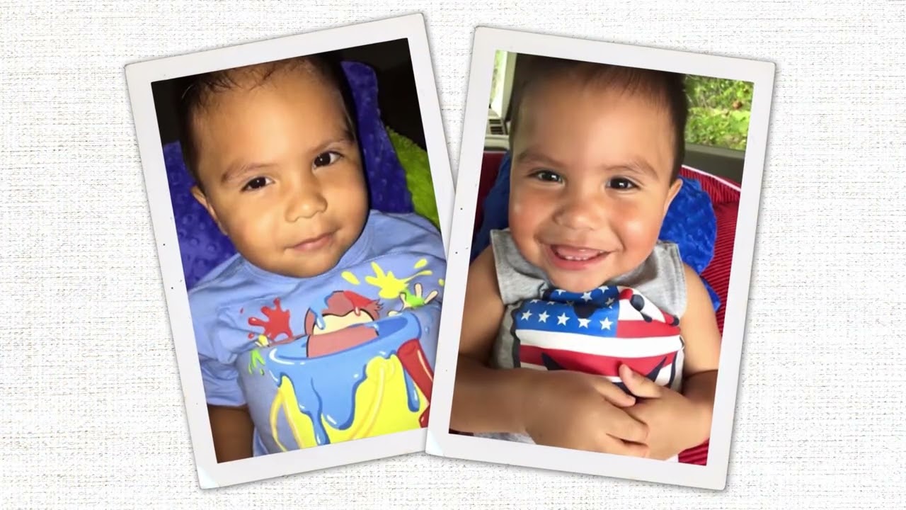 Eli's Story - Osteogenesis Imperfecta