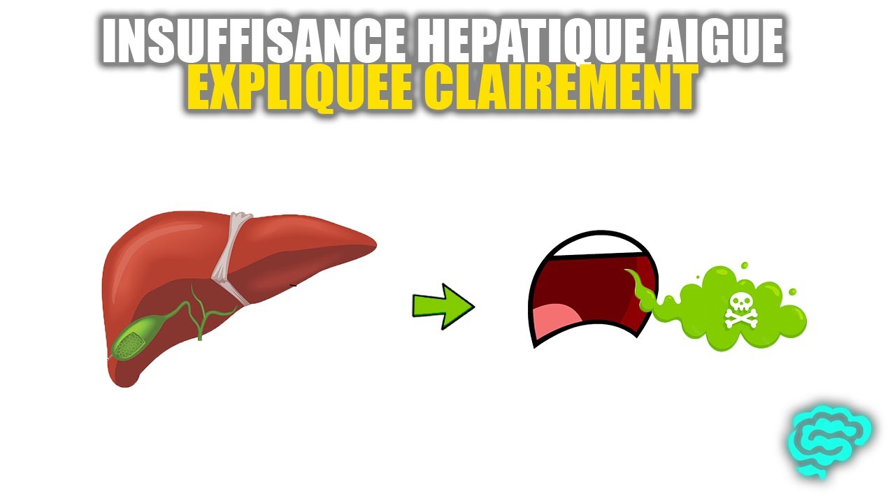 🔴 L'insuffisance Hépatique Expliquée Très Clairement par Dr Astuce