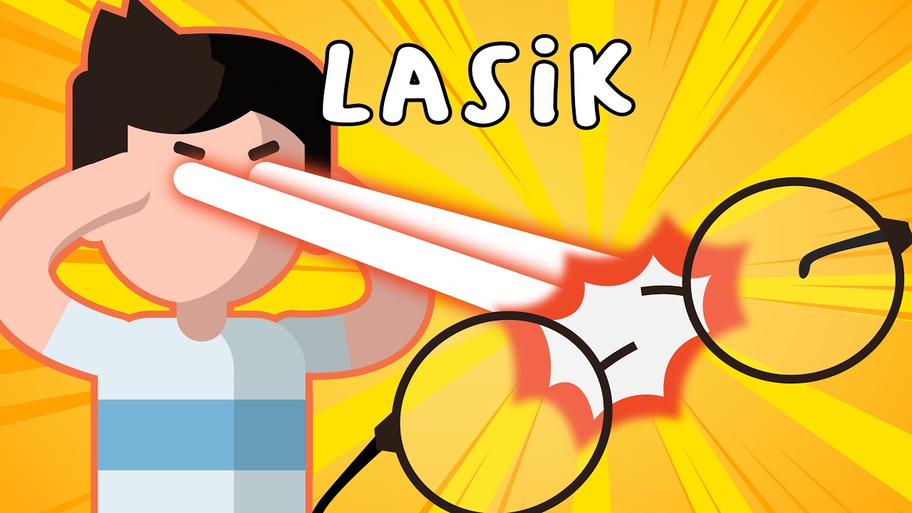 Bahaya Tersembunyi Operasi LASIK