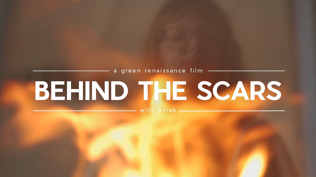 The Scars We Carry: A Story of Resilience & True Beauty