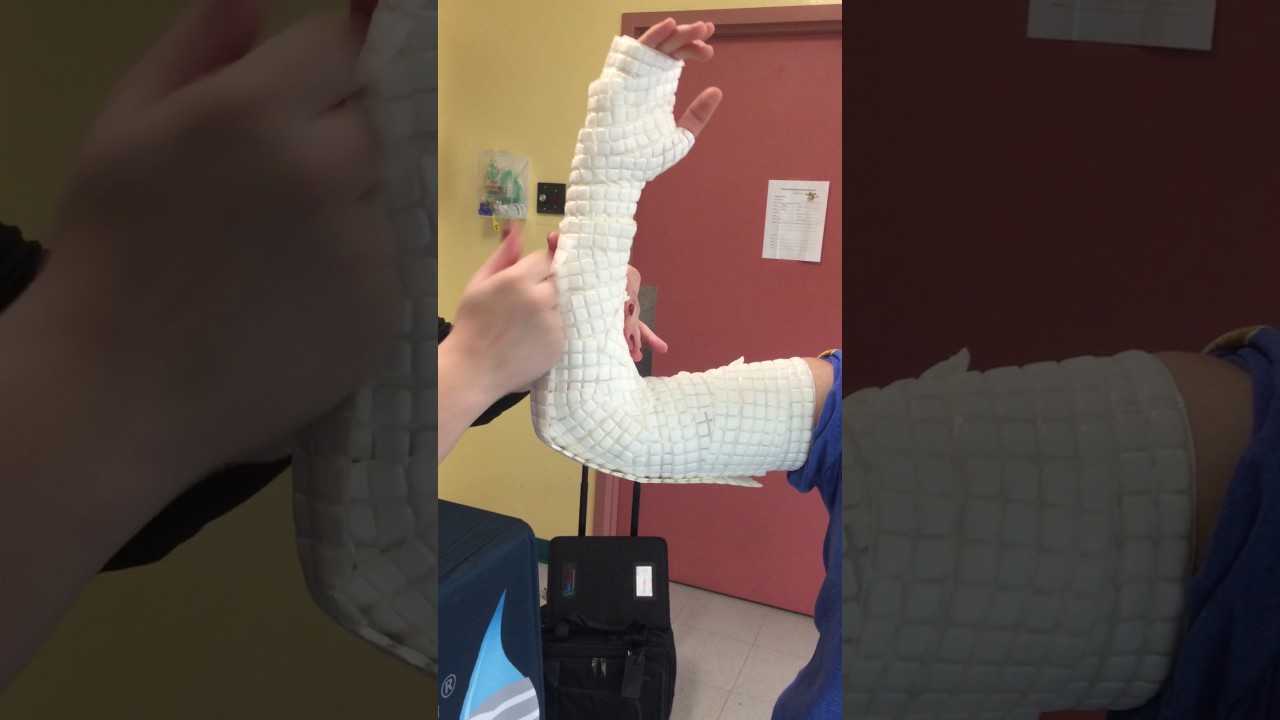 AquaCast Long Arm Cast Application