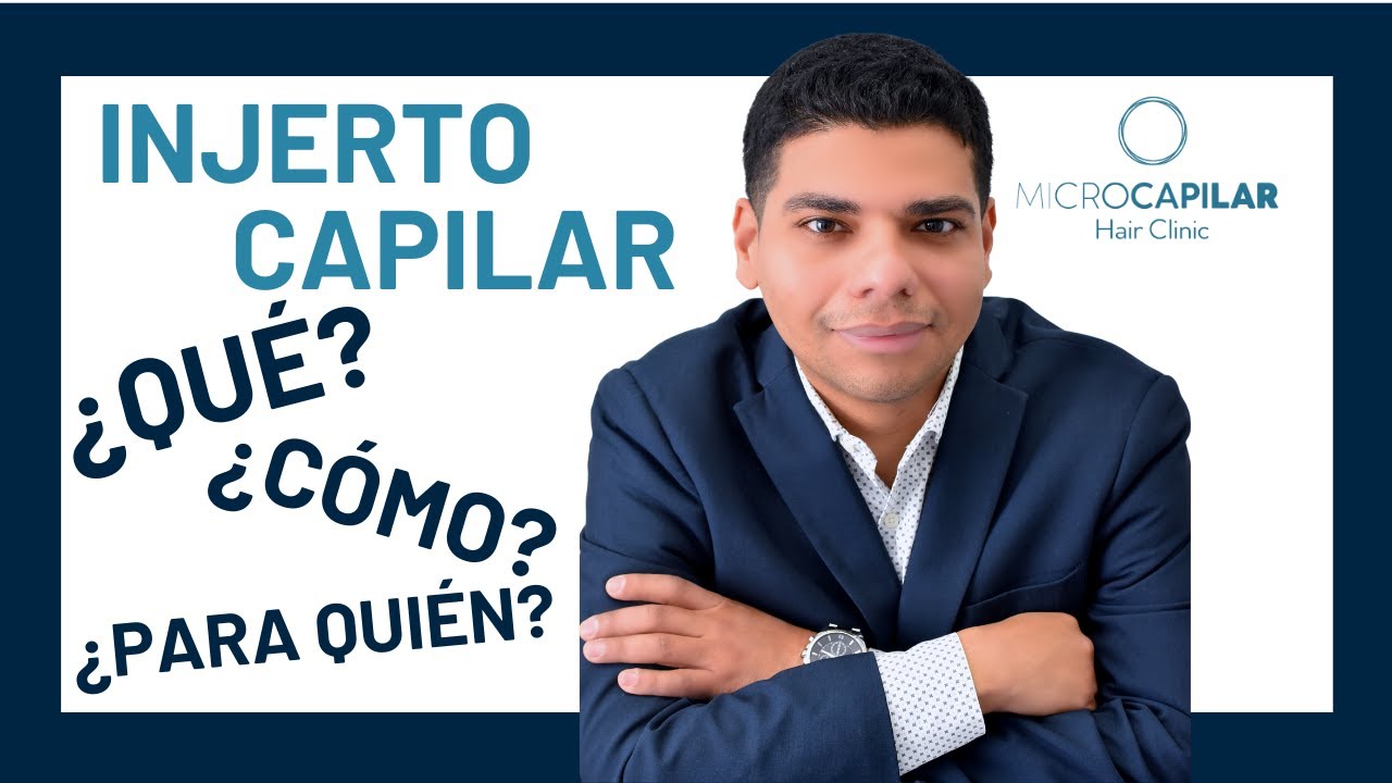👨‍⚕️ INJERTO CAPILAR para hombres y mujeres con TÉCNICA FUE en ESPAÑA.📍