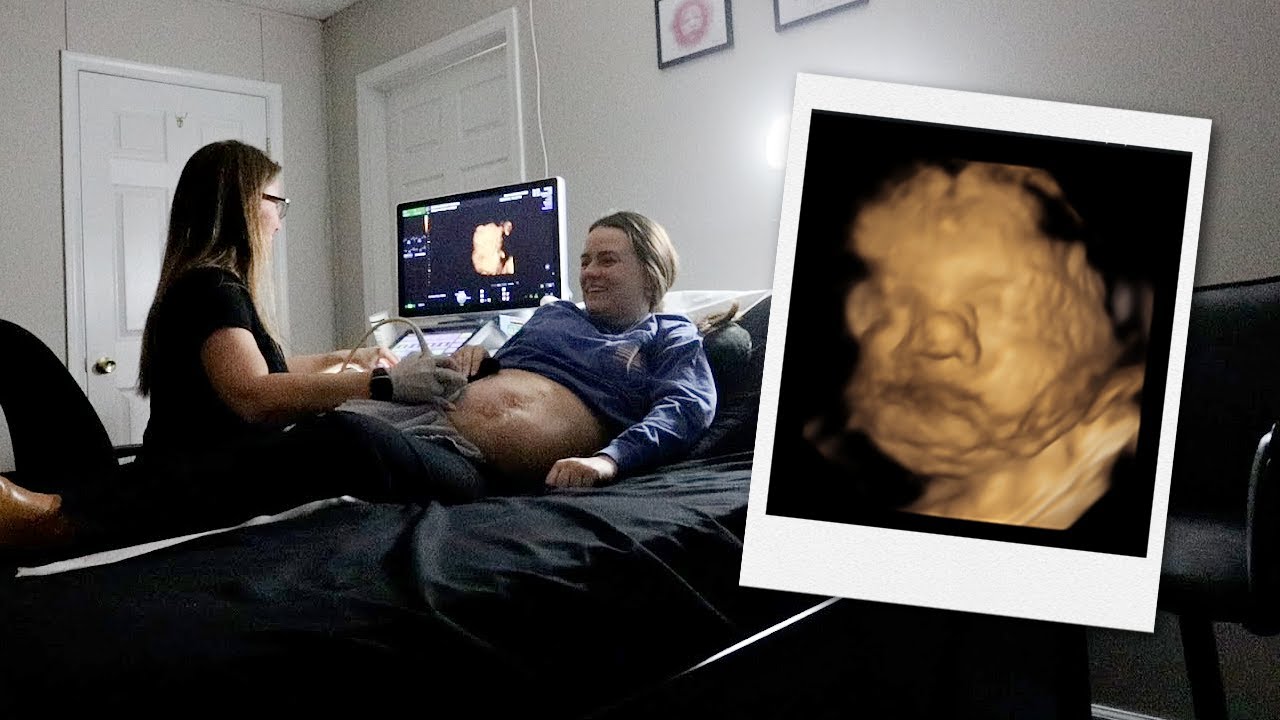 3D/4D Ultrasound with an Ostomy - Come with Us! | 31 Weeks Pregnant | Let's Talk IBD