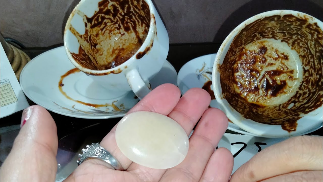 من الاخر شوف حبيبك 🥺🥺🥺💔 من الاخر من غير ولا دوران الحقيقه توجع بس تريح 😍😍😍😍😍🥰