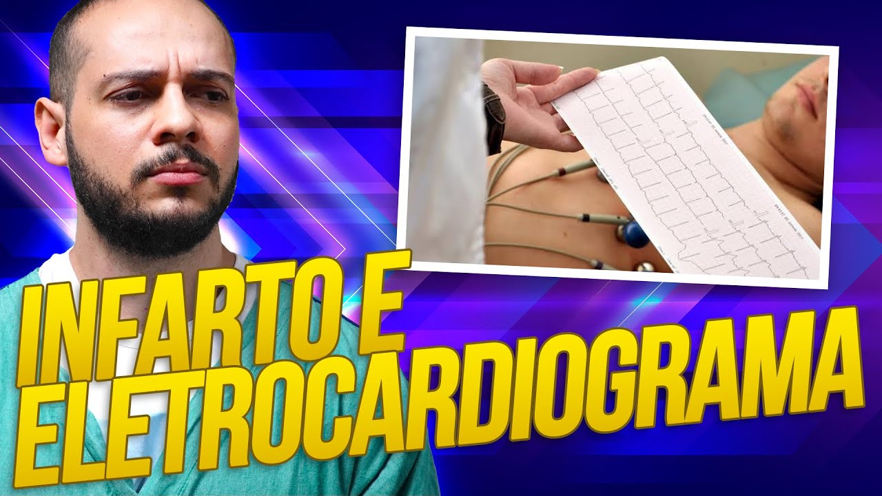 Como reconhecer um Infarto no eletrocardiograma