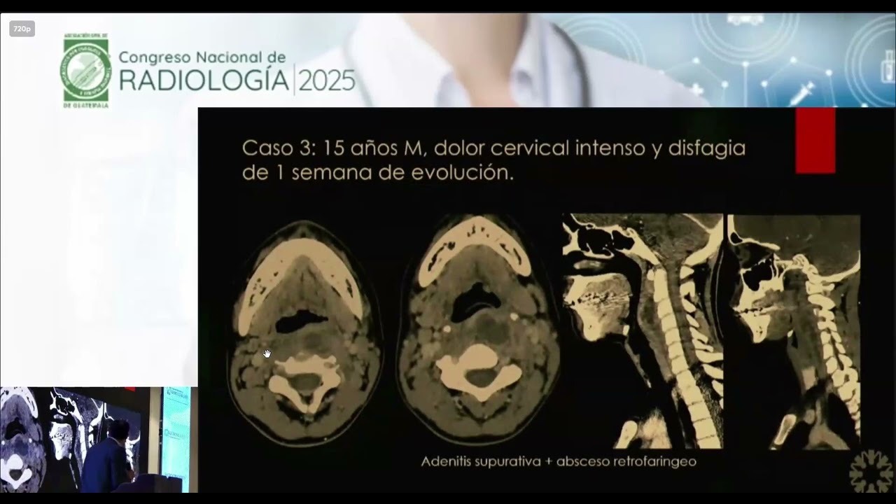 Urgencias no traumáticas en el Cuello