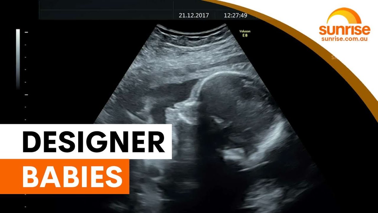 IVF embryo ranking sparks designer baby concerns | Sunrise