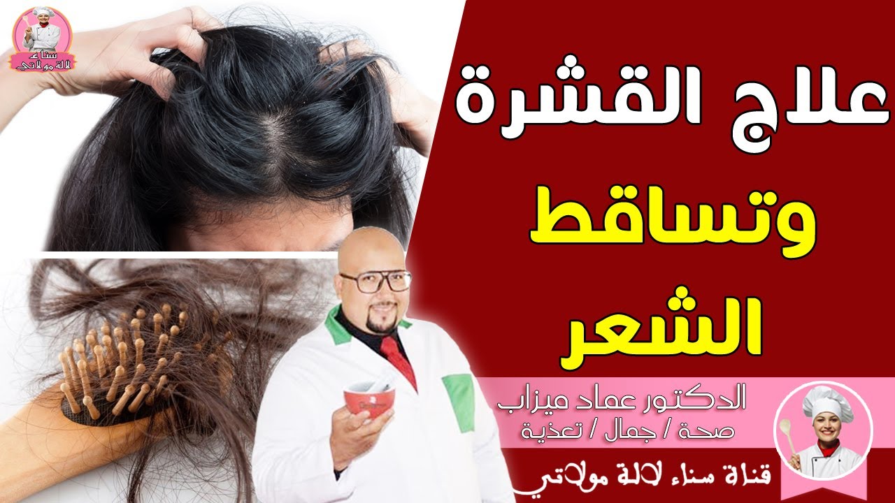وصفة لعلاج مشكل القشرة وتساقط الشعر من عند الدكتور عماد ميزاب